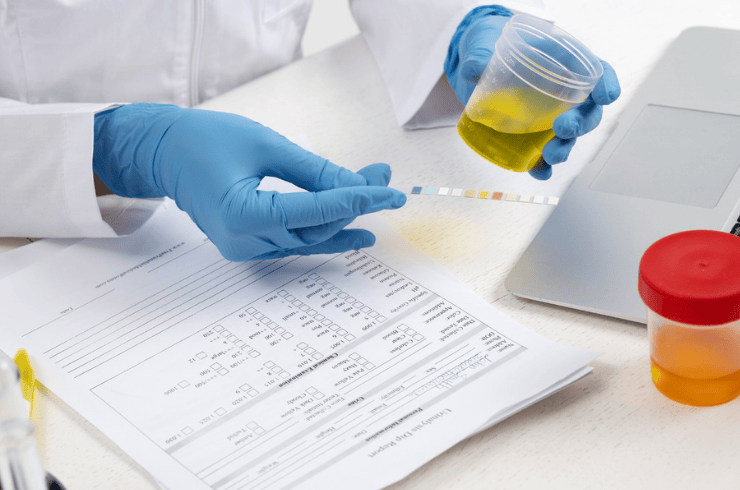 Urine Profile Testing
